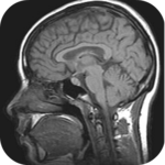 MRI Viewer icon